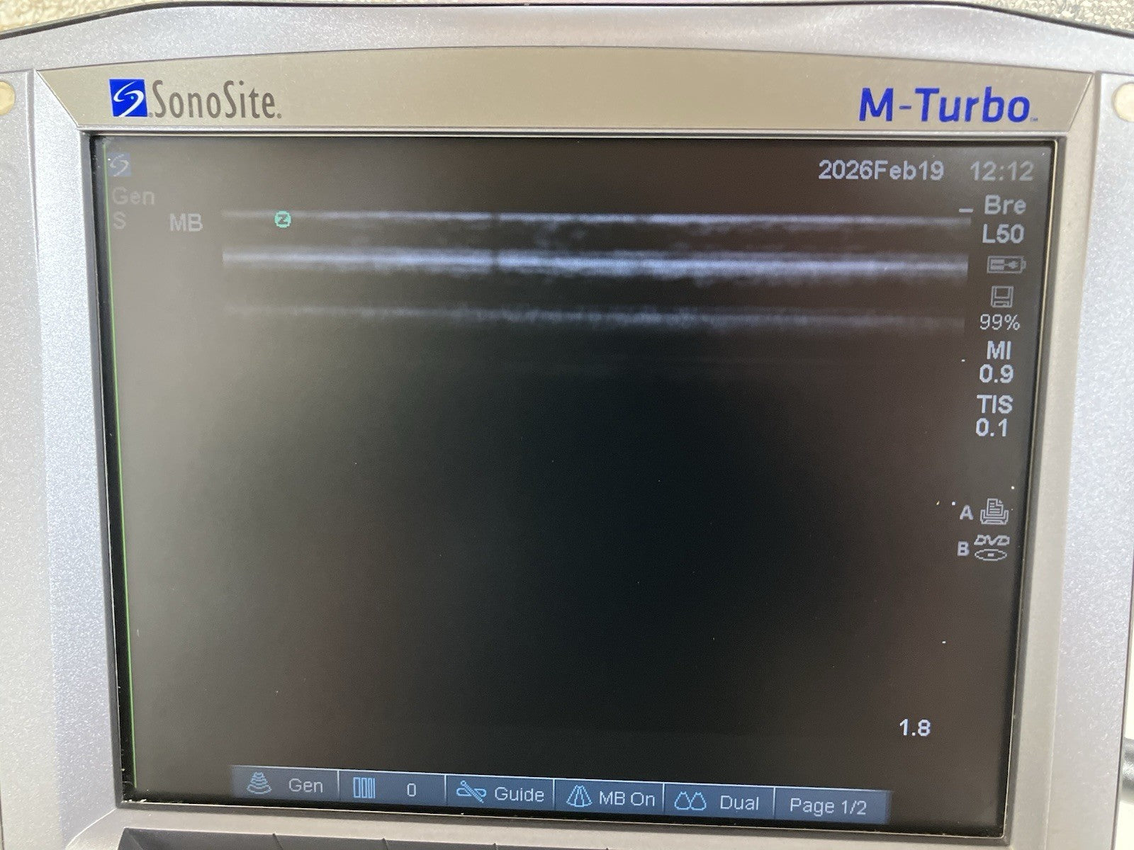 Fujifilm Sonosite HFL50x/15-6 MHz Transducer (REF P07693-70A) — 30 Day Warranty!