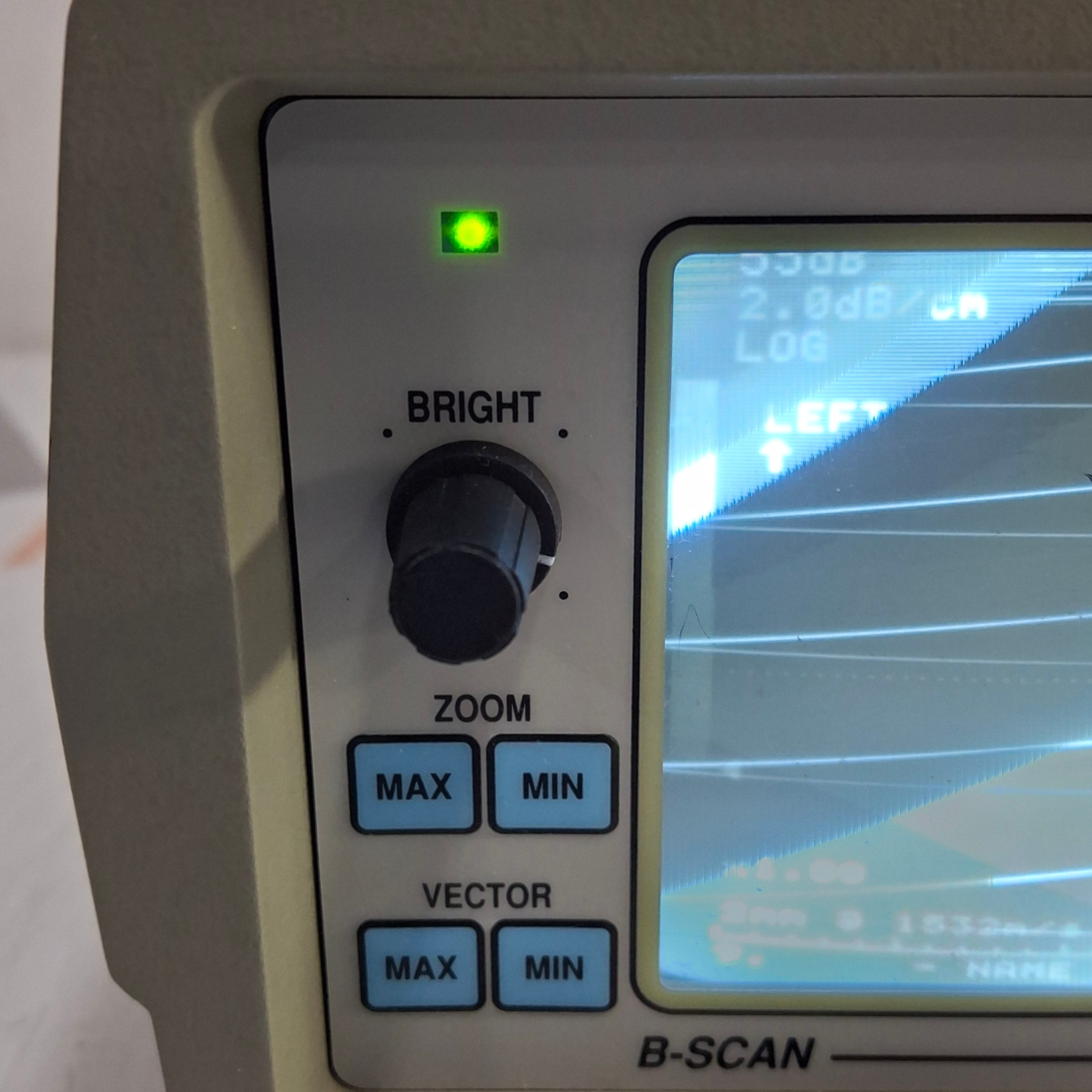 Sonomed Escalon B-Scan 1500 Ophthalmic Ultrasound