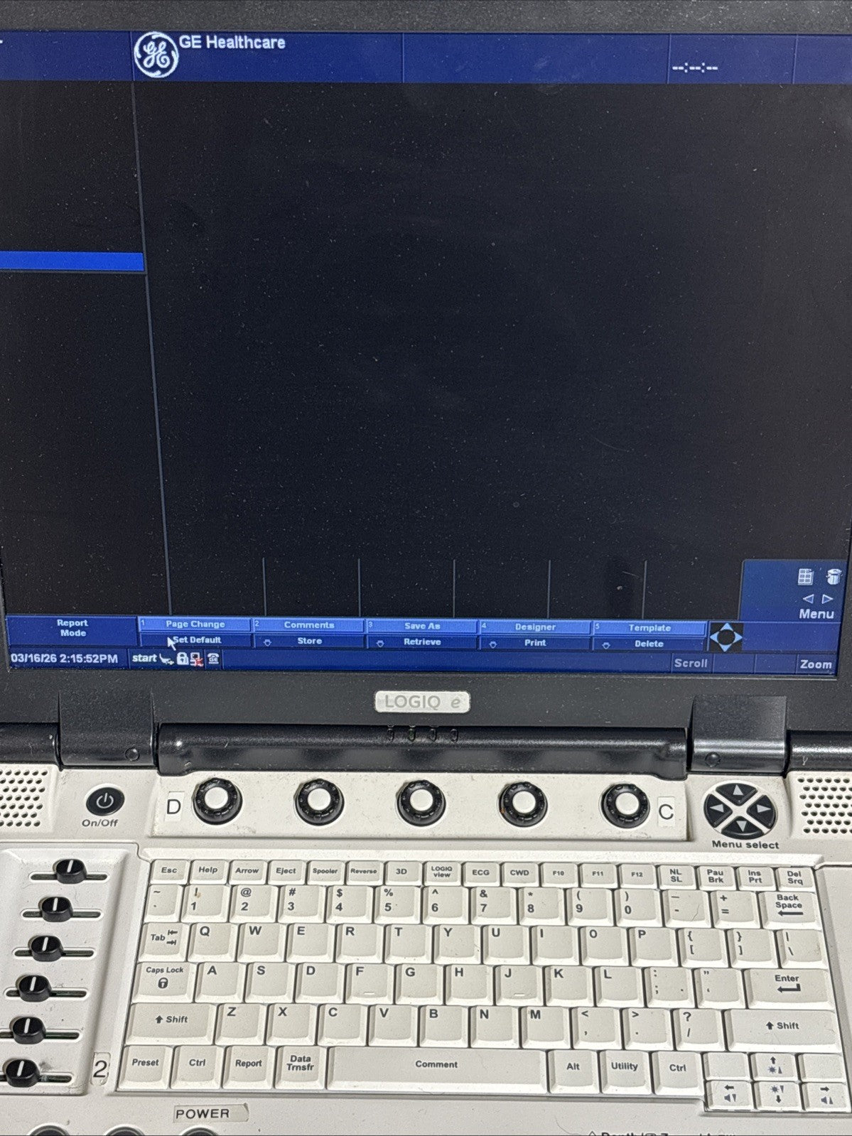 GE Logiq E Ultrasound System (REF: 5419804) With Power Supply — 30 Day Warranty!